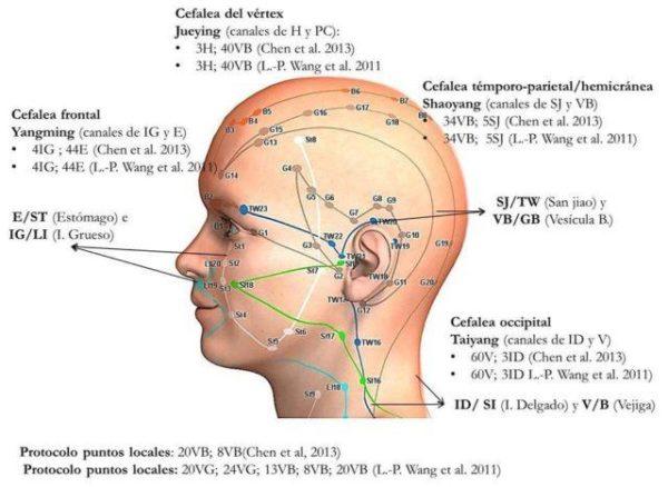 tratamientos de acupuntura y neuralgia del trigemino