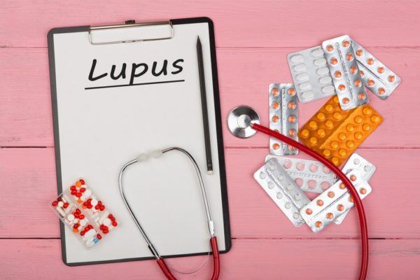 Lupus 